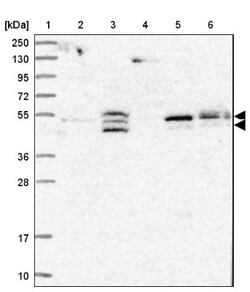 LYPLA3 Antibody, Novus Biologicals 25 &mu;L | Buy Online | Novus Biologicals | Fisher Scientific