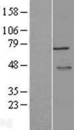 Novus Biologicals&trade;&nbsp;Metadherin Overexpression Lysate