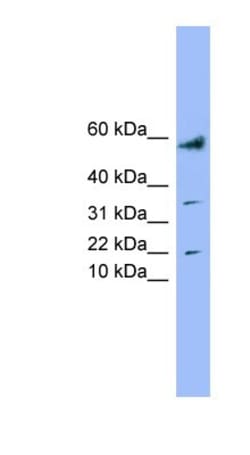 LYRM1 Antibody, Novus Biologicals 100&mu;L; Unlabeled:Antibodies, Polyclonal