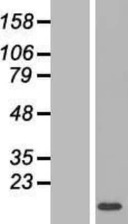 Novus Biologicals&trade;&nbsp;LYRM1 Overexpression Lysate