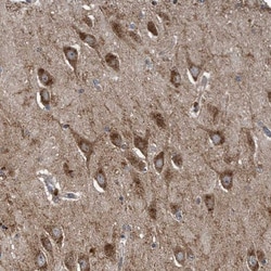 GBE1 Antibody, Novus Biologicals:Antibodies:Primary Antibodies