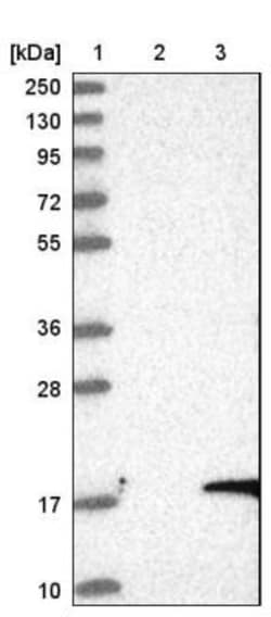 GBE1 Antibody, Novus Biologicals:Antibodies:Primary Antibodies