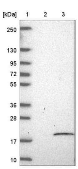 LYRM5 Antibody, Novus Biologicals 25 &mu;L, Unconjugated:Antibodies, Polyclonal