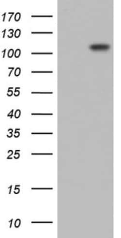 Lysine Hydroxylase 2/PLOD2 Antibody (OTI6D1), Novus Biologicals | Buy Online | Novus Biologicals | Fisher Scientific