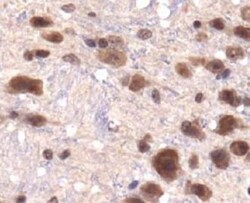 Lysine (K)-specific Demethylase 3A/KDM3A/JMJD1A Antibody - BSA Free, Novus