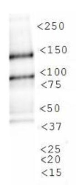Lysine (K)-specific Demethylase 3A/KDM3A/JMJD1A Antibody - BSA Free, Novus