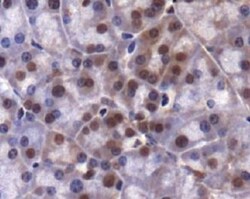 Lysine (K)-specific Demethylase 4A/KDM4A/JMJD2A Antibody - BSA Free, Novus