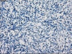 Lysine (K)-specific Demethylase 4C/KDM4C/JMJD2C Antibody (OTI5B9), Novus