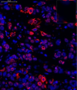 Lysine (K)-specific Demethylase 5B/KDM5B/JARID1B Antibody, Novus Biologicals