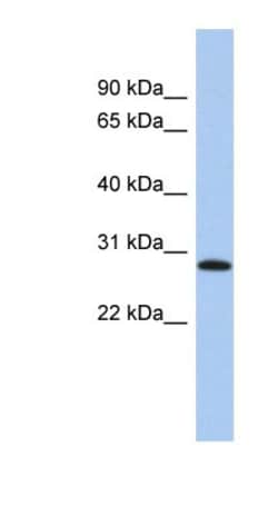 LYSMD1 Antibody, Novus Biologicals 100&mu;L; Unlabeled:Antibodies, Polyclonal