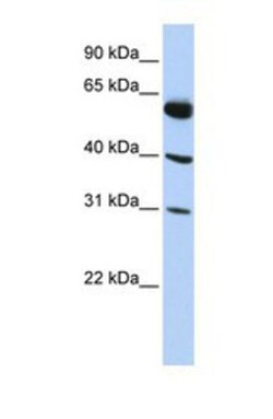 LYSMD4 Antibody, Novus Biologicals 0.05mg; Unlabeled:Antibodies, Polyclonal