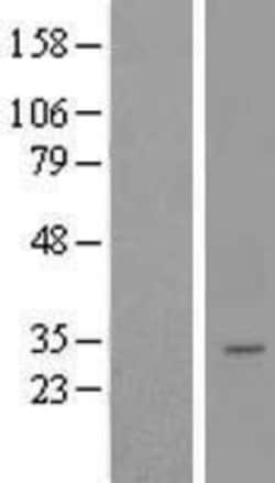 Novus Biologicals&trade;&nbsp;LYSMD4 Overexpression Lysate