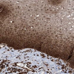 LYSMD4 Antibody, Novus Biologicals 25 &mu;L | Buy Online | Novus Biologicals | Fisher Scientific