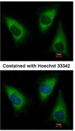 Lysyl tRNA synthetase Antibody, Novus Biologicals 0.1mL; Unlabeled:Antibodies,