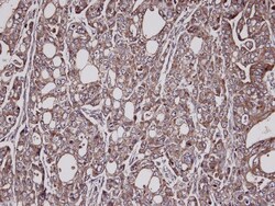 Lysyl tRNA synthetase Antibody, Novus Biologicals 0.1mL; Unlabeled:Antibodies,