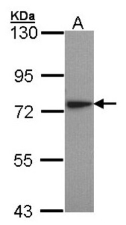 Lysyl tRNA synthetase Antibody, Novus Biologicals 0.1mL; Unlabeled:Antibodies,
