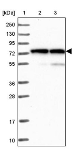 Lysyl tRNA synthetase Antibody, Novus Biologicals 0.1mL; Unlabeled:Antibodies,