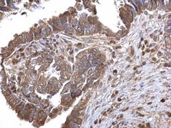 Lysyl Oxidase Homolog 2/LOXL2 Antibody, Novus Biologicals 0.1mg; Unlabeled:Antibodies,