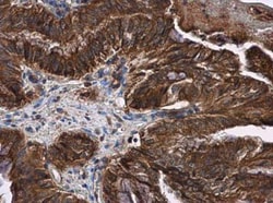 Lysyl Oxidase Homolog 2/LOXL2 Antibody, Novus Biologicals 0.1mg; Unlabeled:Antibodies,