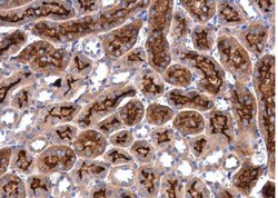 Lysyl Oxidase Homolog 2/LOXL2 Antibody, Novus Biologicals 0.1mg; Unlabeled:Antibodies,