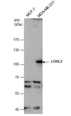 Lysyl Oxidase Homolog 2/LOXL2 Antibody, Novus Biologicals 0.1mg; Unlabeled:Antibodies,