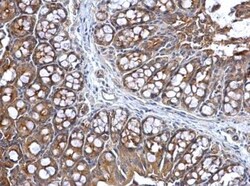 Lysyl tRNA synthetase Antibody, Novus Biologicals 0.1mL; Unlabeled:Antibodies,