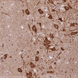 Lysyl tRNA synthetase Antibody, Novus Biologicals 0.1mL; Unlabeled:Antibodies,