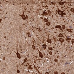 Lysyl tRNA synthetase Antibody, Novus Biologicals 0.1mL; Unlabeled:Antibodies,