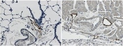 LYVE-1 Antibody (RM0033-4D17) - Azide and BSA Free, Novus Biologicals 0.025