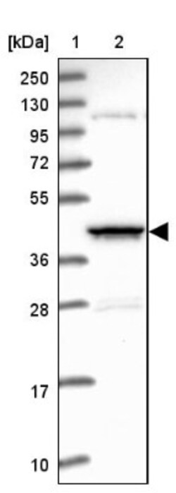 LYVE-1 Antibody, Novus Biologicals 0.1mL; Unlabeled:Antibodies, Polyclonal