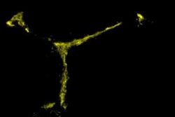 LYVE-1 Antibody, Novus Biologicals 0.025mg; Unlabeled:Antibodies, Polyclonal