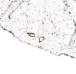LYVE-1 Antibody - BSA Free, Novus Biologicals 0.1mL; Unlabeled:Antibodies,