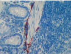LYVE-1 Antibody, Novus Biologicals 0.025mg; Unlabeled:Antibodies, Polyclonal