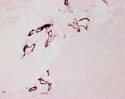 LYVE-1 Antibody, Novus Biologicals 0.025mg; Unlabeled:Antibodies, Polyclonal