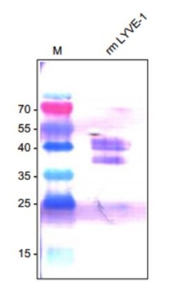 LYVE-1 Antibody, Novus Biologicals 0.025mg; Unlabeled:Antibodies, Polyclonal