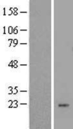 Novus Biologicals&trade;&nbsp;LYZL1 Overexpression Lysate