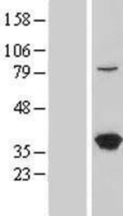 Novus Biologicals&trade;&nbsp;LZTFL1 Overexpression Lysate