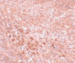 LZTR2 Antibody - BSA Free, Novus Biologicals 0.1mg; Unlabeled:Antibodies,