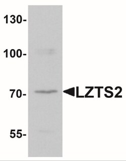 LZTS2 Antibody - BSA Free, Novus Biologicals 0.025 mg, Unlabeled:Antibodies,