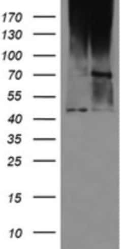 MAB21L3 Antibody (OTI2A3), Novus Biologicals 0.1mL; Unlabeled:Antibodies,