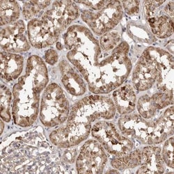 MACC1 Antibody, Novus Biologicals 25 &mu;L | Buy Online | Novus Biologicals | Fisher Scientific