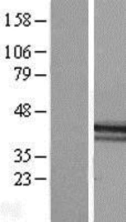 Novus Biologicals&trade;&nbsp;Macro H2A.2 Overexpression Lysate