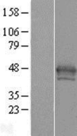 Novus Biologicals&trade;&nbsp;Histone H2AY/macroH2A.1 Overexpression Lysate