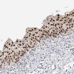 Macro H2A.2 Antibody, Novus Biologicals 25 &mu;L, Unconjugated:Antibodies,