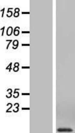 Novus Biologicals&trade;&nbsp;CCL3/MIP-1 alpha Overexpression Lysate