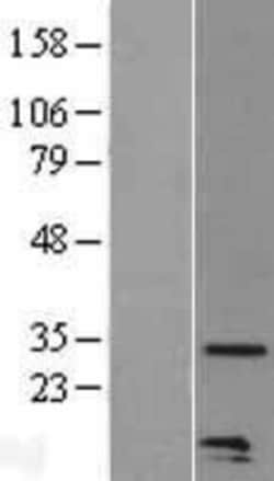 Novus Biologicals&trade;&nbsp;CCL20/MIP-3 alpha Overexpression Lysate