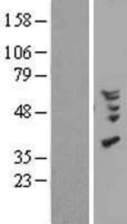 Novus Biologicals&trade;&nbsp;CCL18/PARC Overexpression Lysate