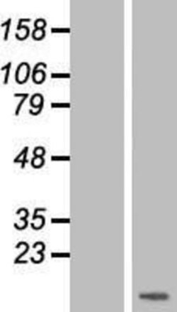 Novus Biologicals&trade;&nbsp;CCL15/MIP-1 delta Overexpression Lysate