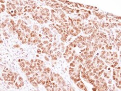 MAD1L1/MAD1 Antibody, Novus Biologicals 0.1mg; Unlabeled:Antibodies, Polyclonal