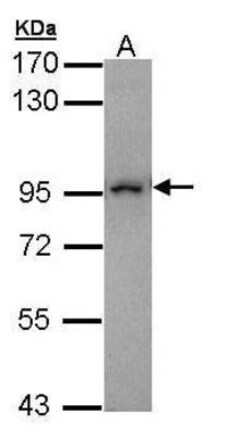 MAD1L1/MAD1 Antibody, Novus Biologicals 0.1mg; Unlabeled:Antibodies, Polyclonal